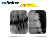 Tıbbi 30KHz 0.1MA 60KV RVG Dental X Ray Makinesi